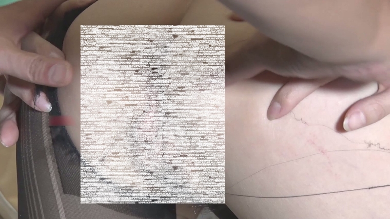 17144911756
