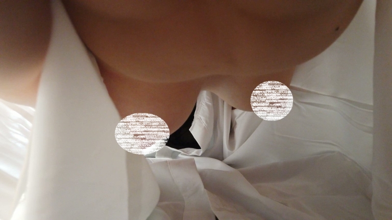03044511631